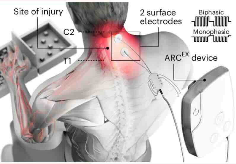 深度解析：TEAS 与 TENS —— 从原理到临床实战